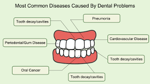 Anatomy of human teeth – conditions and treatment