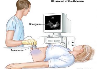 Description about the method of Ultrasound or sonography