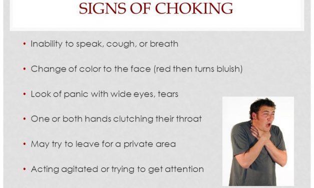 About necessary First aid in case of chocking