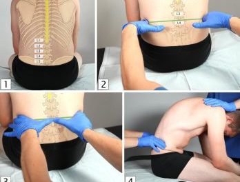 Lumbar puncture is a test performed in lower back